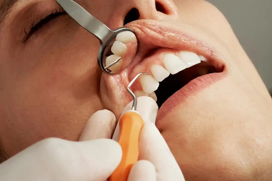 Dental check up