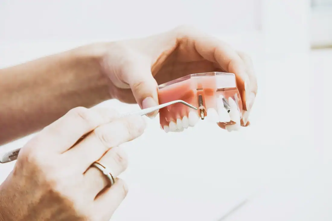 new artificial tooth in mould