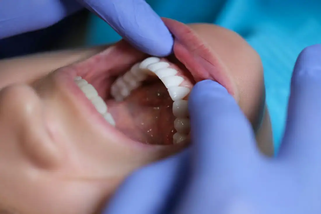 Doctor dentist examining patient oral cavity