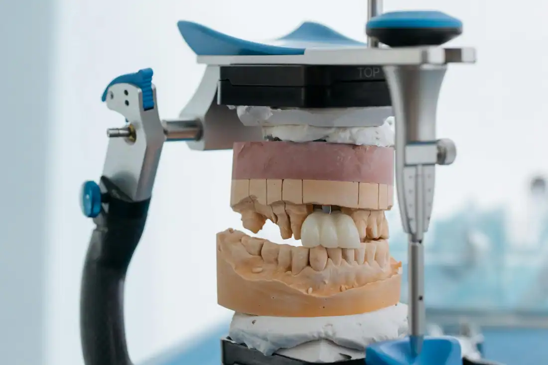 dental bridge machinery