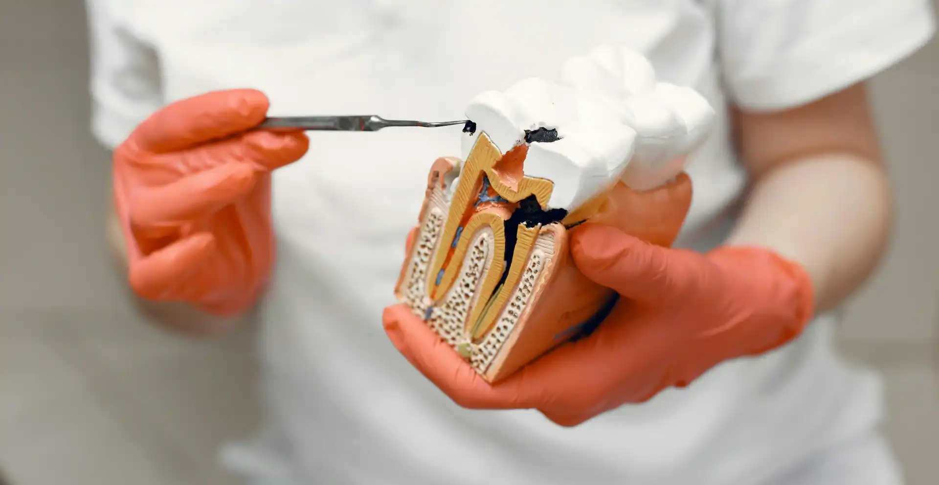 How Do I Know If I Need A Root Canal Or A Filling