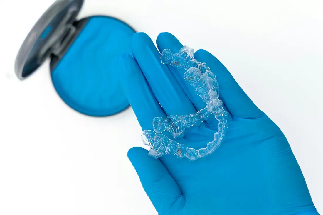 Image showcasing How Invisalign Straightens Teeth Without the Hassle of Braces