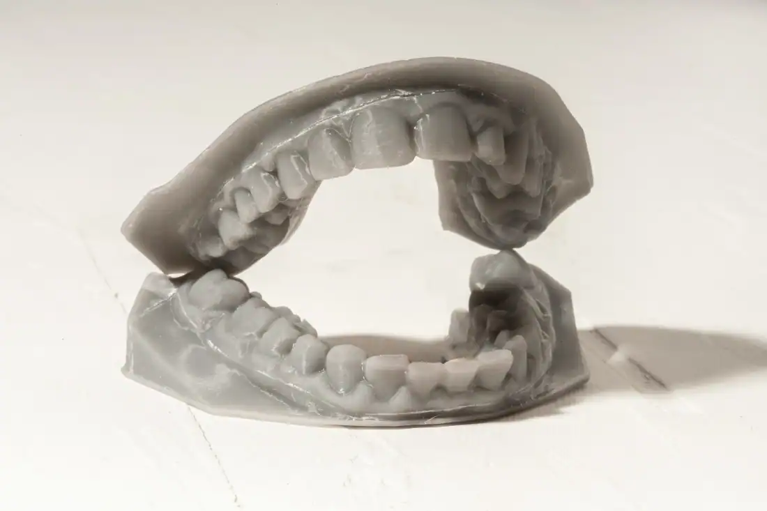 dental impressions by dentist