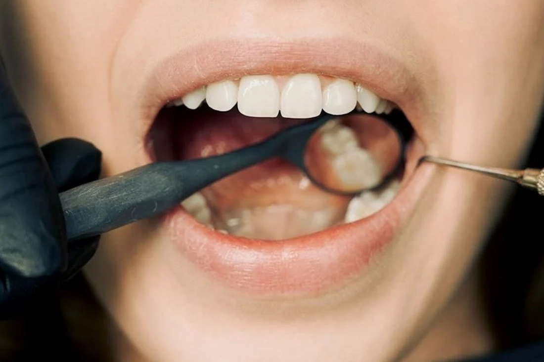 healthy teeth and gums
