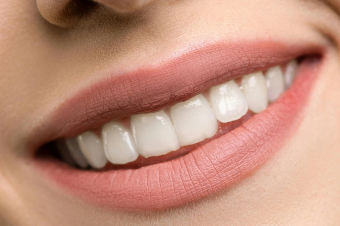 beautiful smile due to good dental hygiene habits