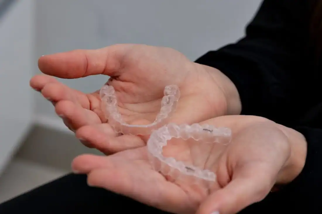  Invisalign on hands
