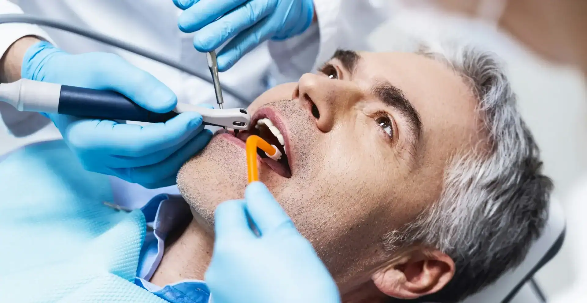 How Long Does A Root Canal Take?