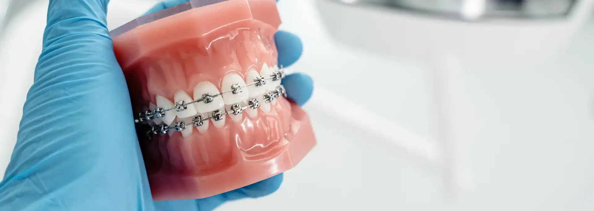 How Much Do Braces Cost in Oklahoma City