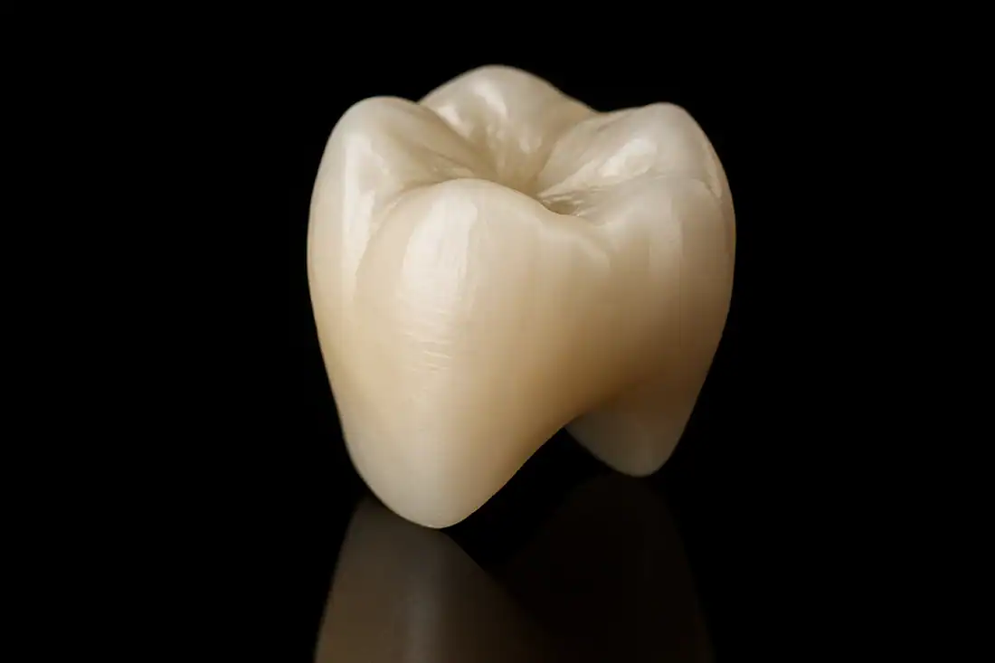temporary crown for patient suffering of tooth decay