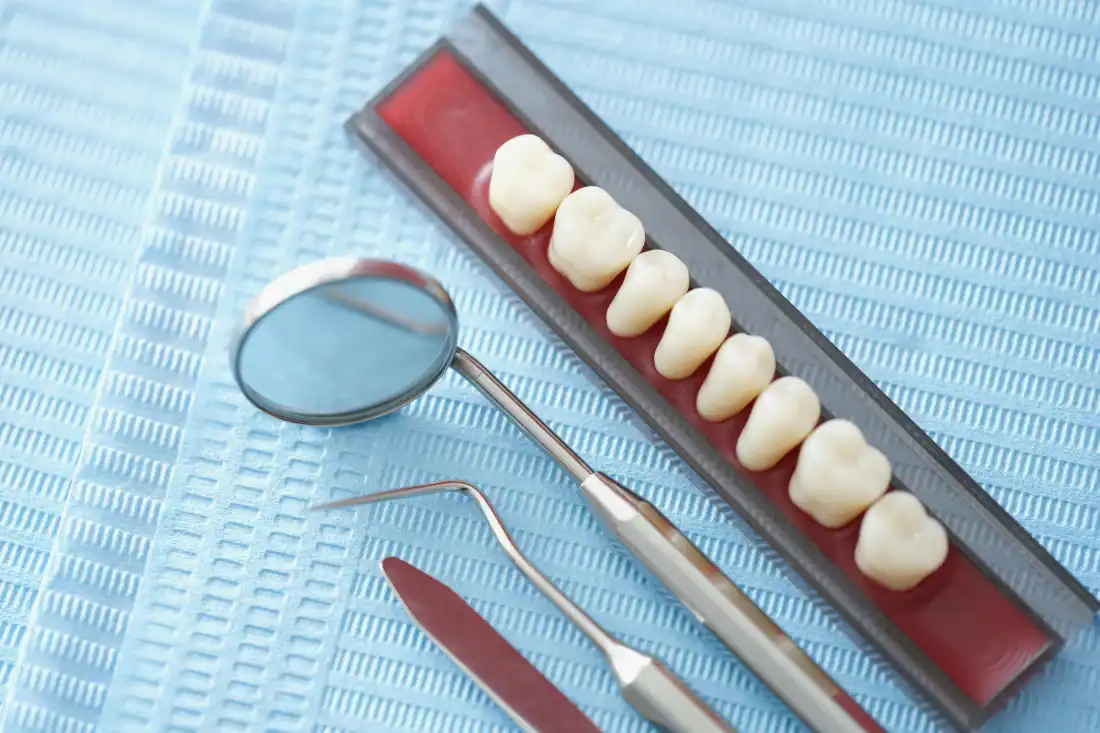 dental crowns that cover the entire tooth