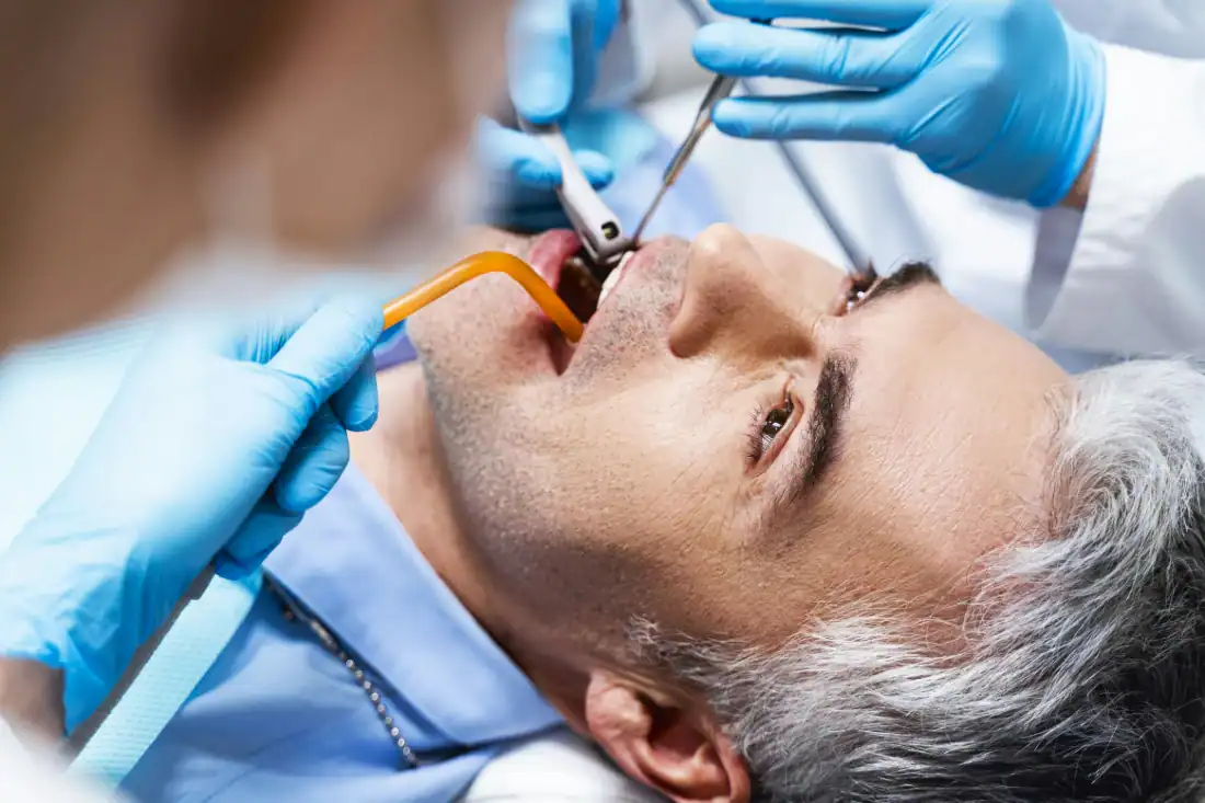 man undergoing root canal treatment