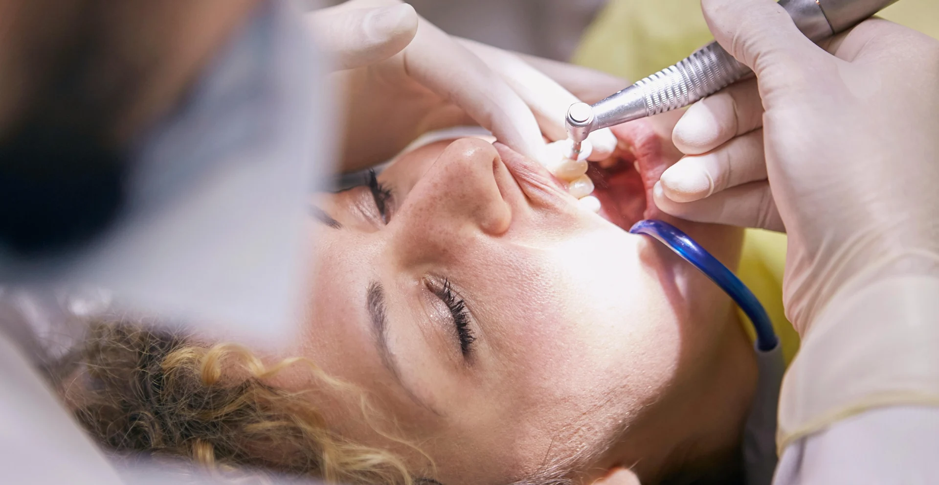 How to Relieve Pain After Teeth Cleaning