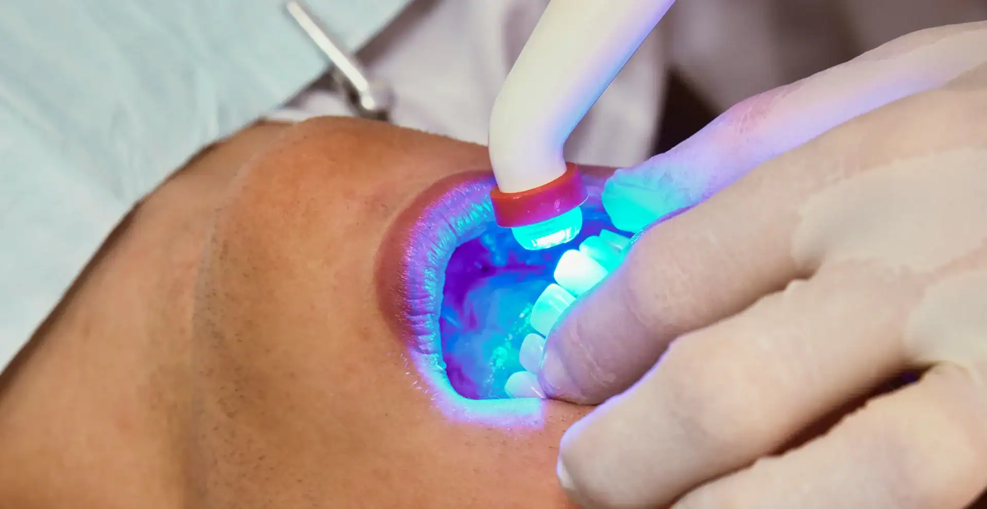 Is Laser Dentistry Right for You? Here’s What You Need to Know