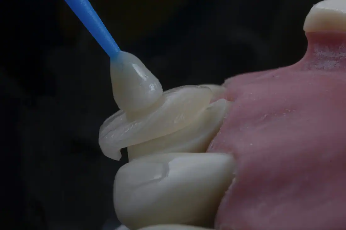 a close-up of a toothbrush