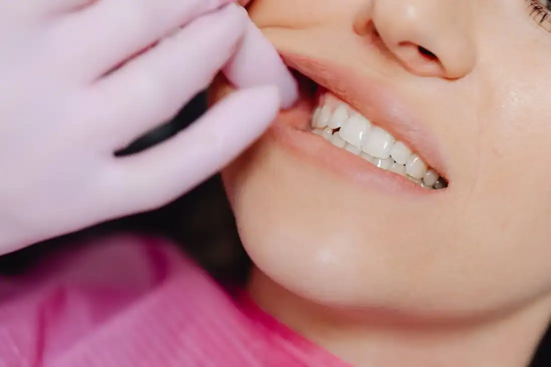 women with beautiful set of teeth