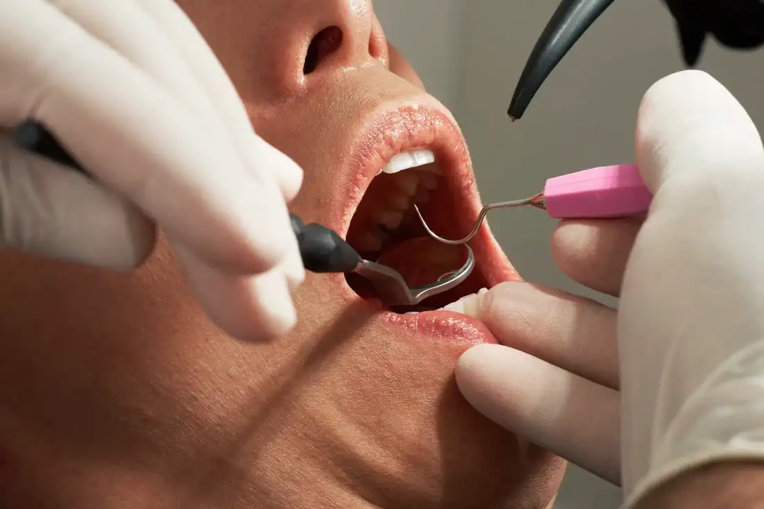Sedation Dentistry