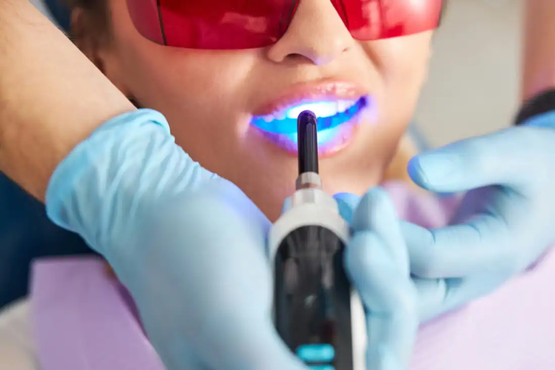 dental laser treatment