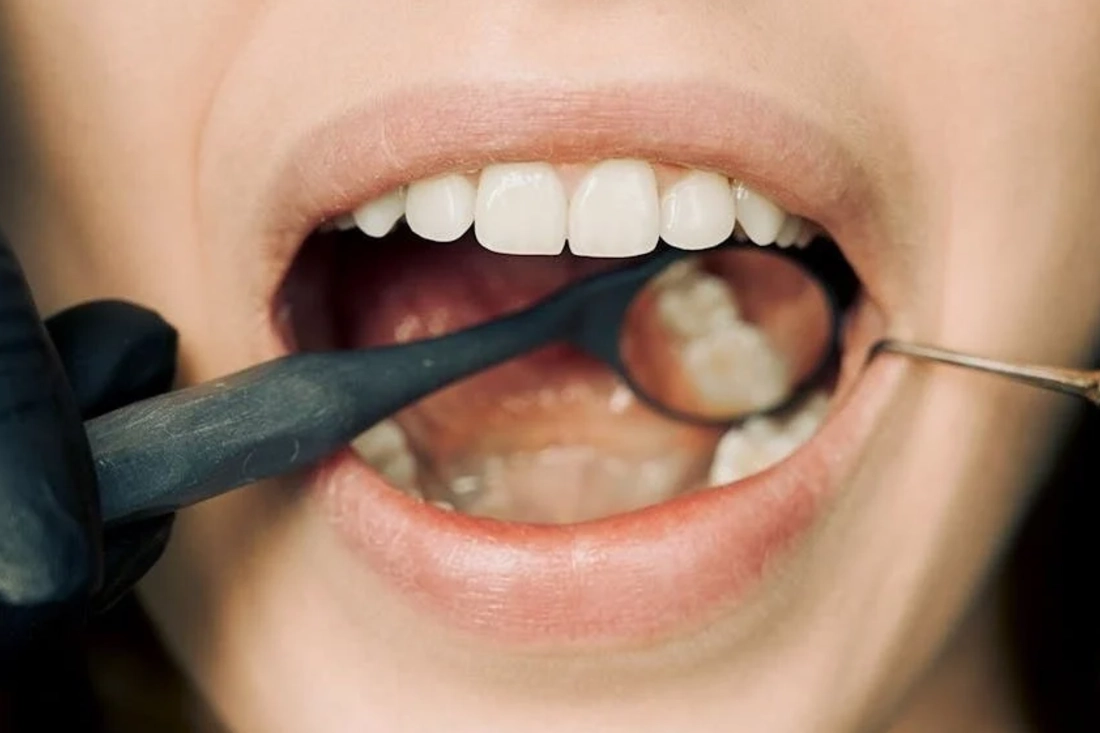 Close-up of a dental examination with modern equipment, showcasing oral hygiene maintenance.