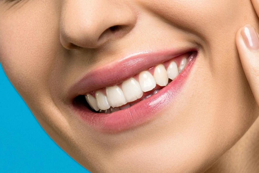 woman with veneers smiling