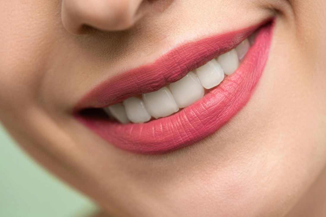 woman with dental crowns smiling