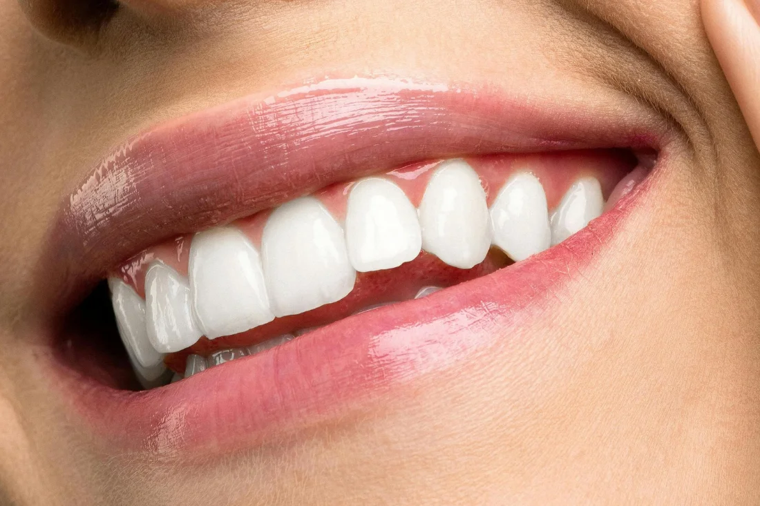 Person smiling after teeth restoration procedure