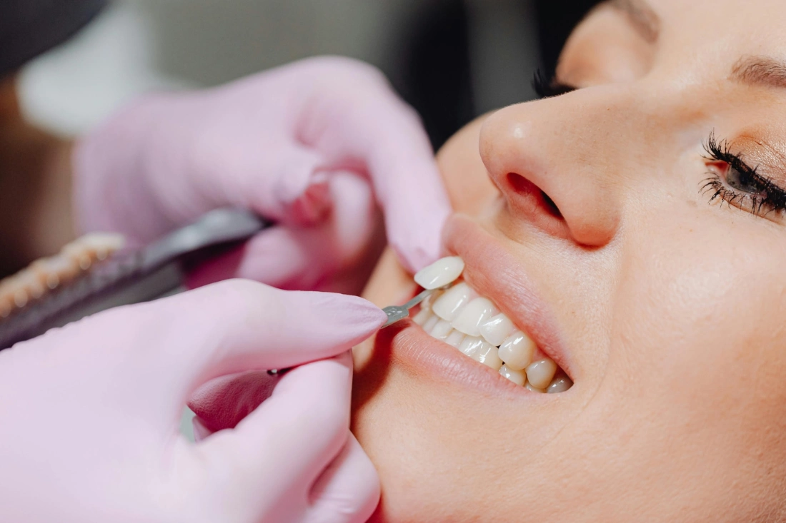 A dentist wearing mask and gloves placing porcelain veneers.