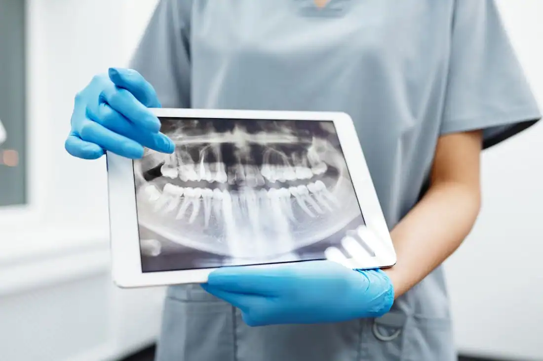 dental x-ray