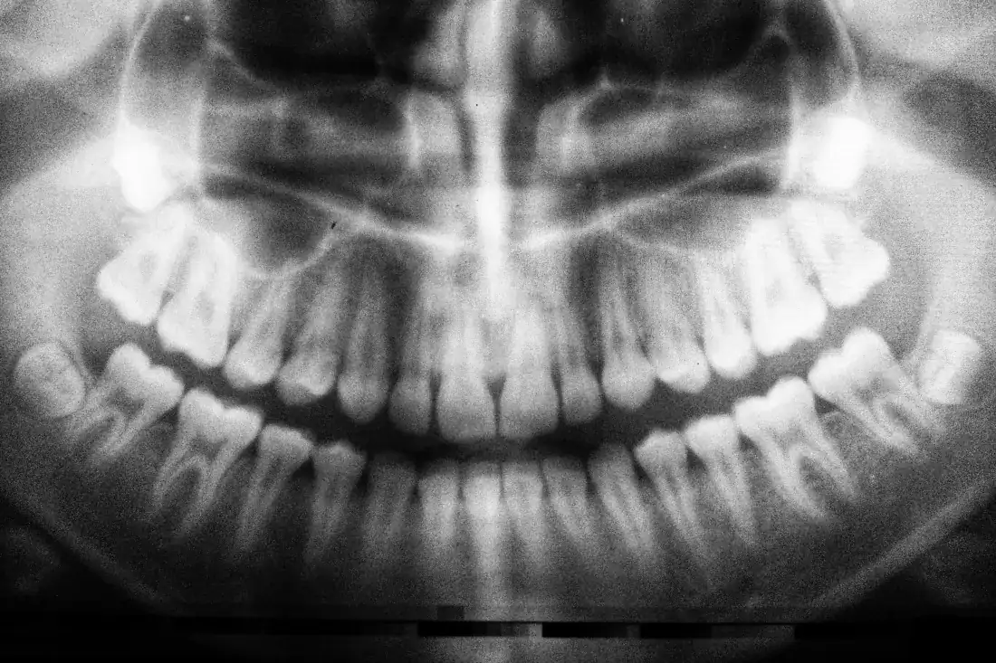 dental xray