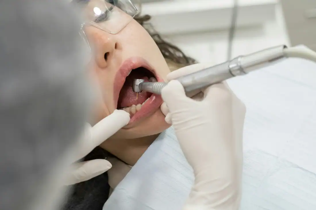 dentist drilling patient's teeth