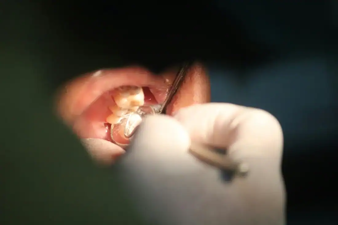 dentist looking inside patient's mouth