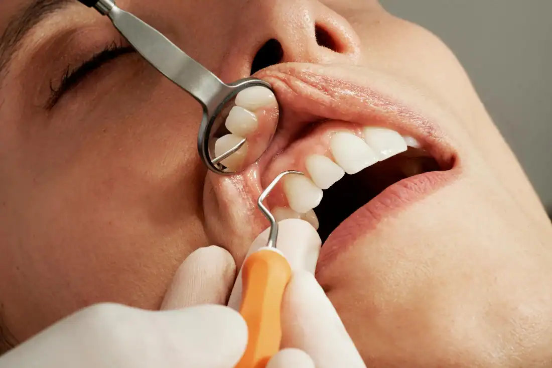 doctor looking at patient's gums