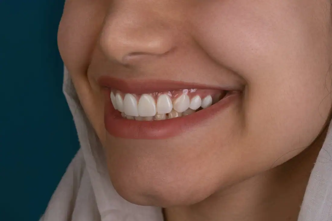 smiling woman with healthy teeth and gums