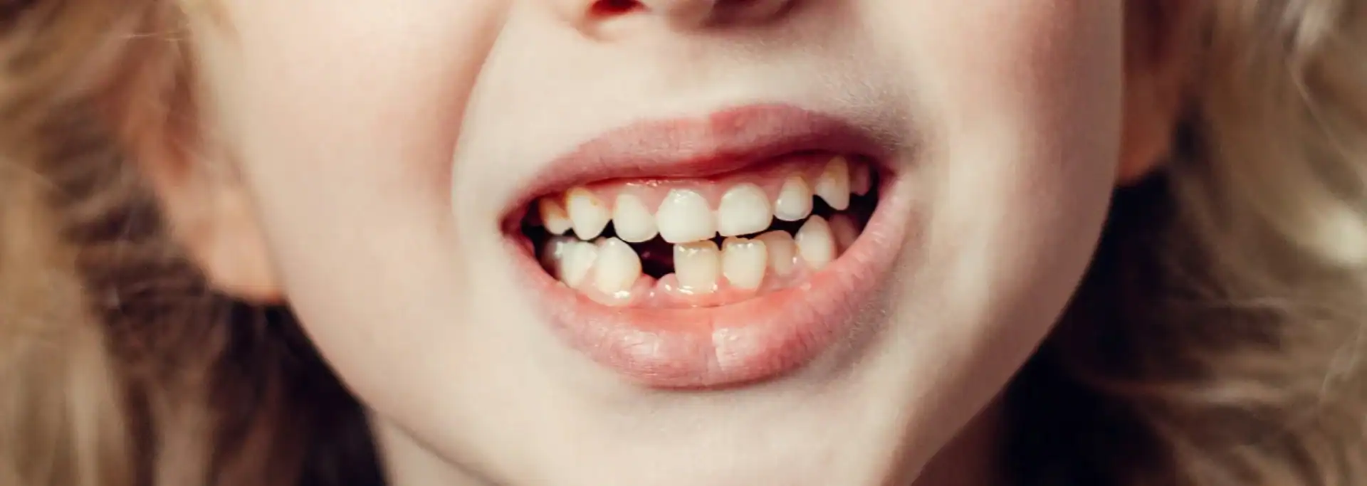 tooth extraction in oklahoma city