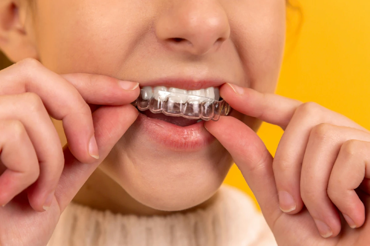 woman putting on clear aligners
